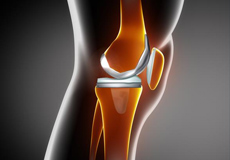 Same Day Knee Replacement